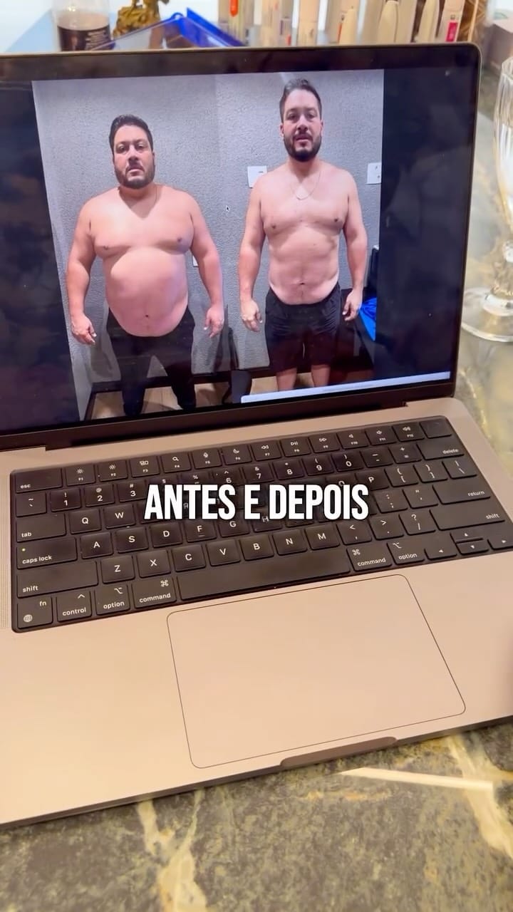 Post 8 by Mateus Osório CRMSP 215405 on Instagram (video)