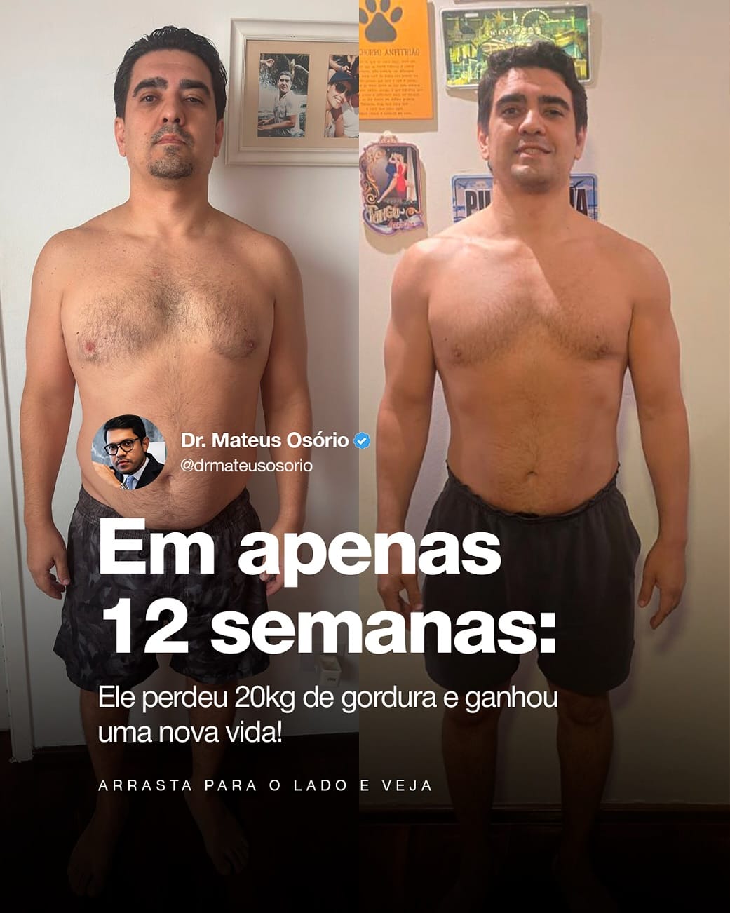 Post 10 by Mateus Osório CRMSP 215405 on Instagram (carousel)