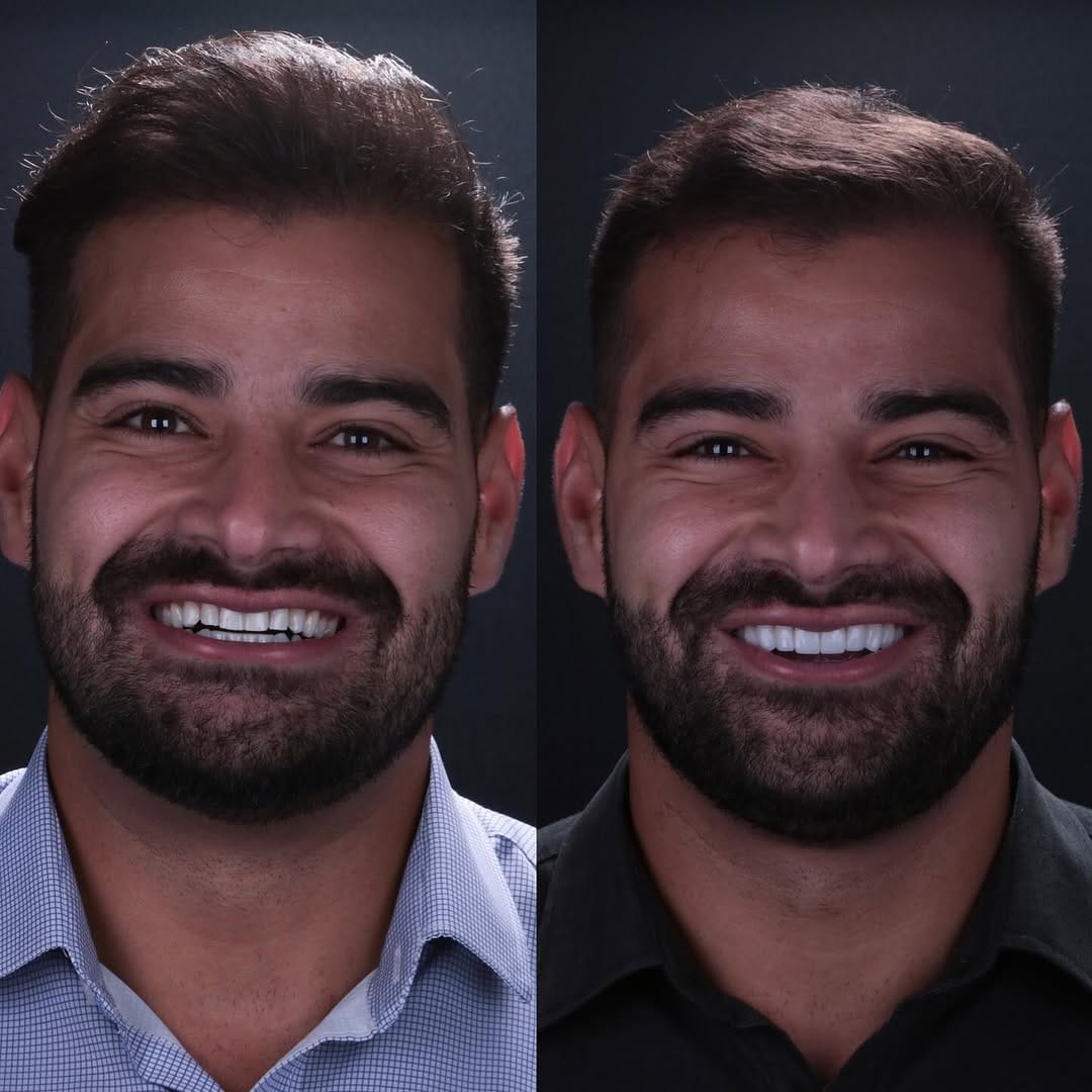 Post 10 by Dr. André L. Sales | Cirurgião Dentista on Instagram (carousel)