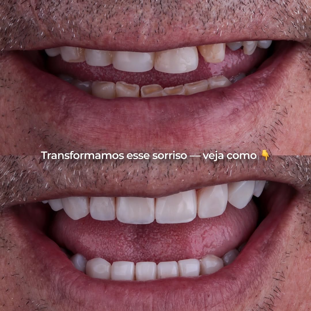 Post 5 by Thanyse Araujo on Instagram (carousel)