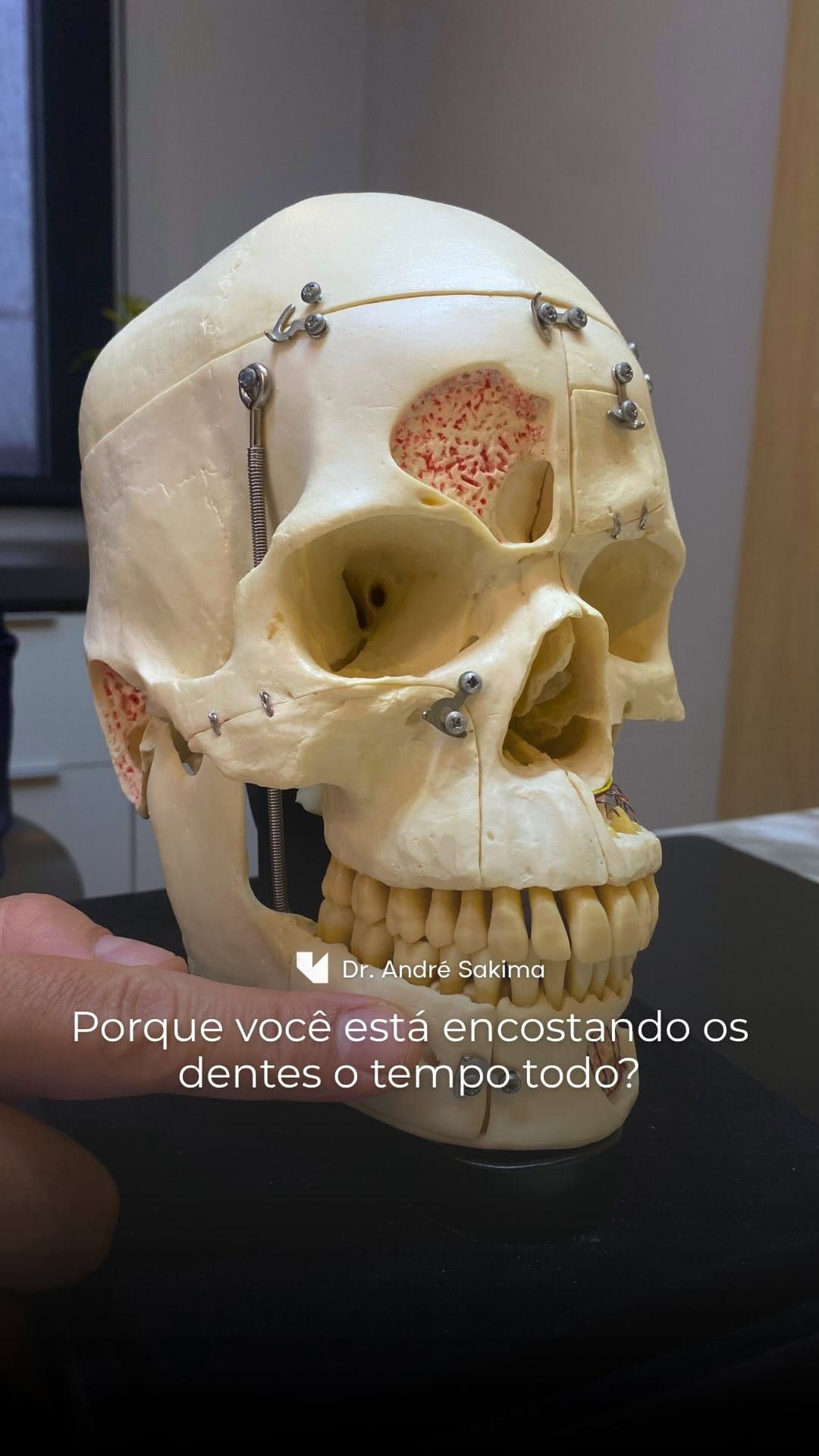 Post 3 by Dr. André Sakima | Ortognática | ATM | Implantes on Instagram (video)