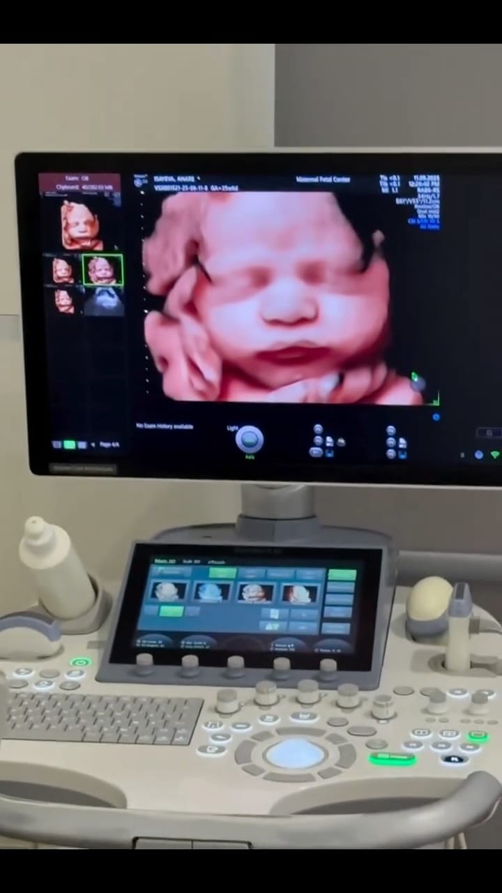 Post 10 by Dr. Şəhla Quliyeva on Instagram (video)