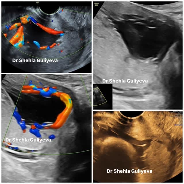 Post 5 by Dr. Şəhla Quliyeva on Instagram (video)