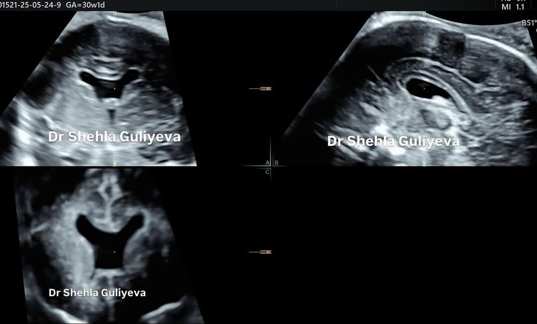 Post 6 by Dr. Şəhla Quliyeva on Instagram (image)