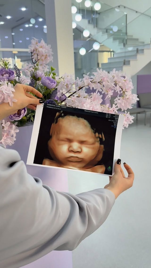 Post 9 by Dr. Şəhla Quliyeva on Instagram (video)