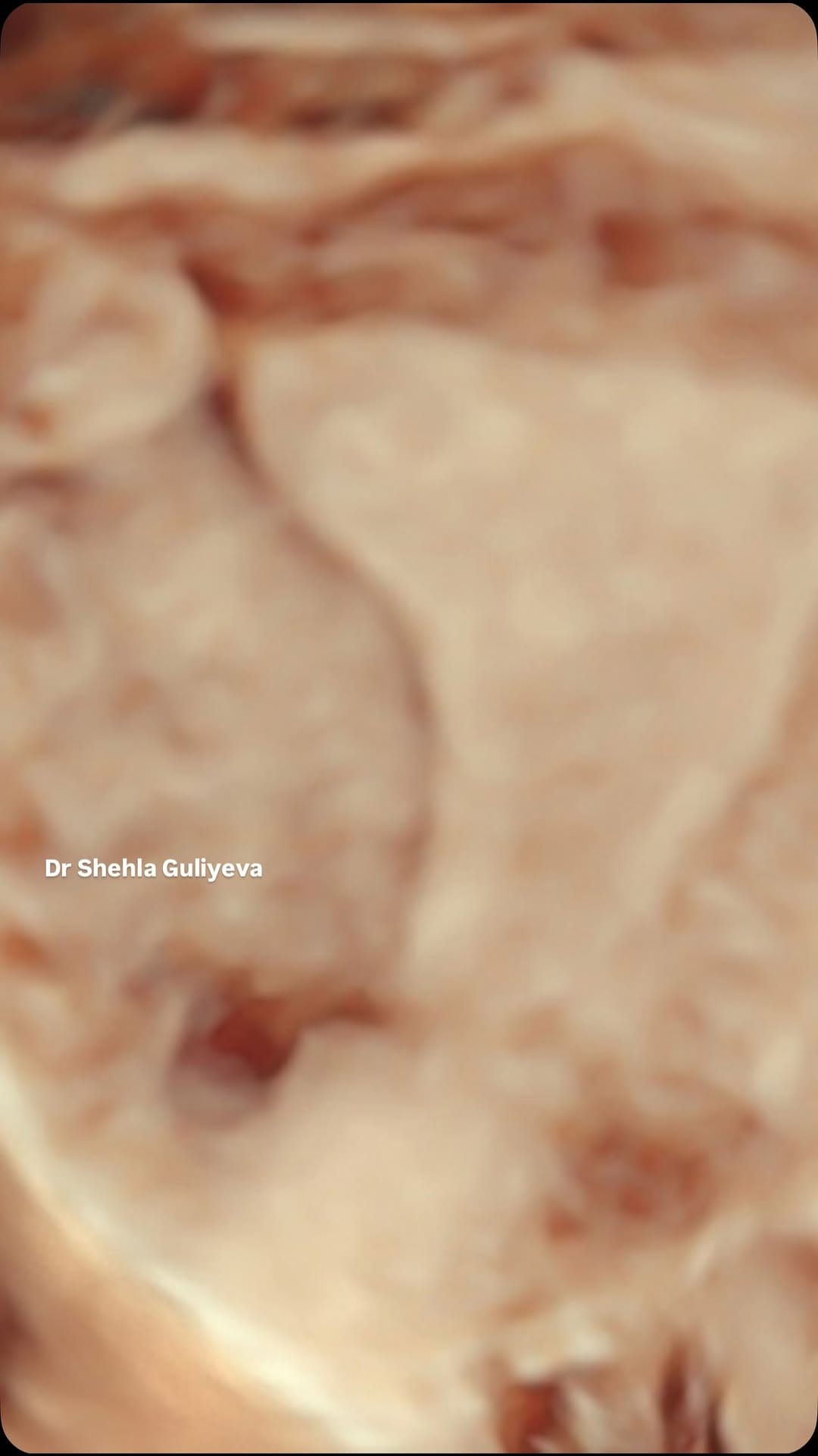 Post 3 by Dr. Şəhla Quliyeva on Instagram (video)