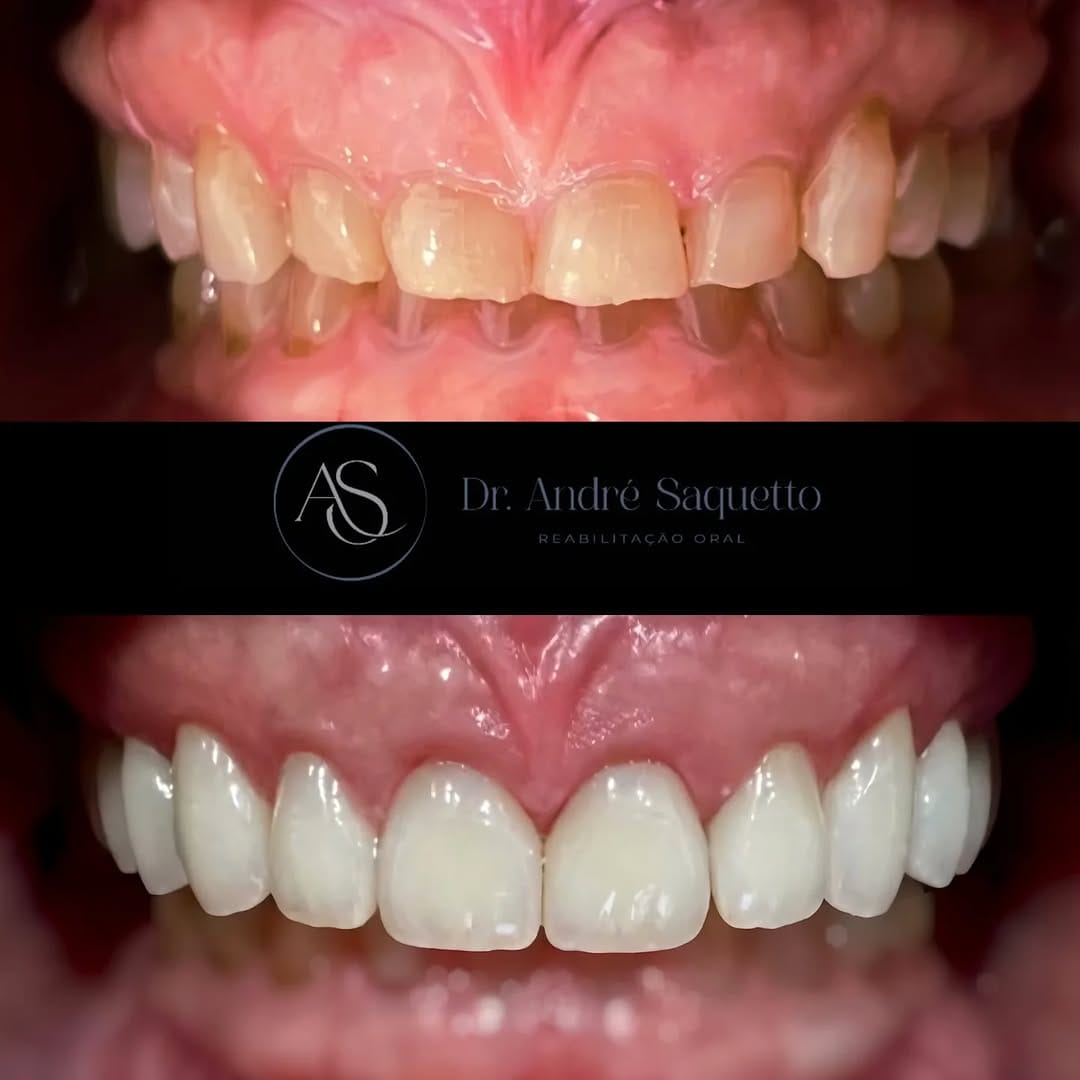 Post 2 by Rayane Magnol | Cirurgiã Dentista on Instagram (carousel)