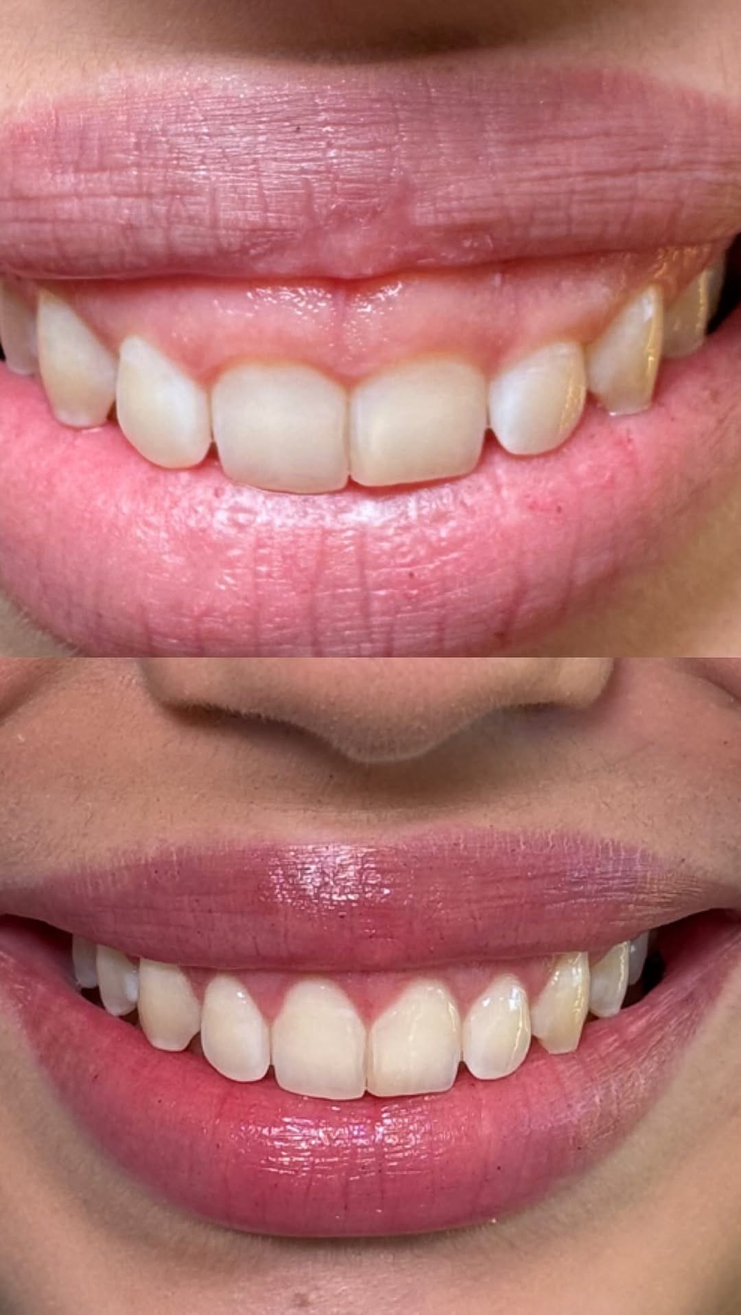Post 1 by Rayane Magnol | Cirurgiã Dentista on Instagram (video)