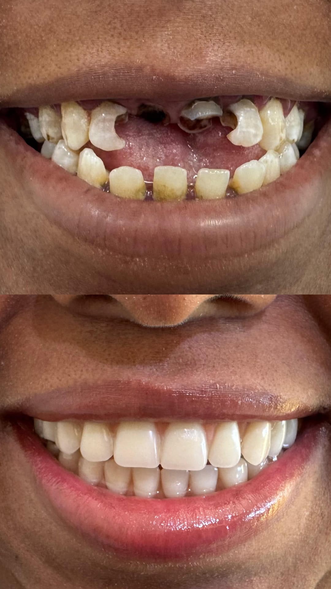 Post 5 by Rayane Magnol | Cirurgiã Dentista on Instagram (video)