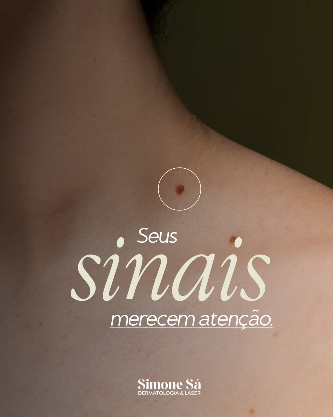 Post 2 by Dra Simone Sá | Dermatologista em Macapá on Instagram (carousel)