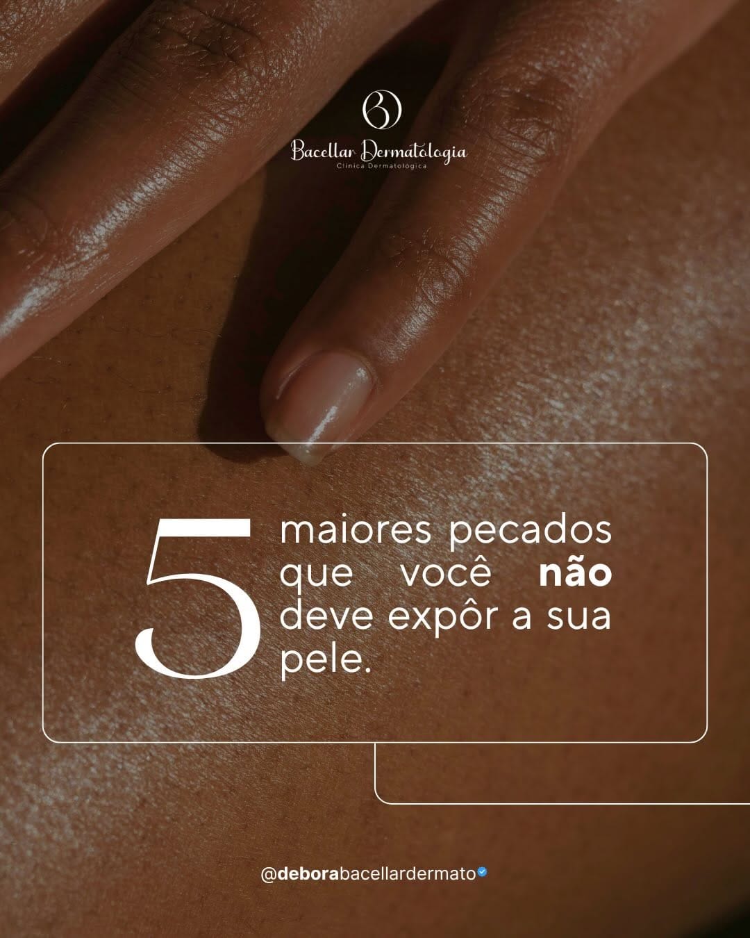 Post 9 by Dra. Débora Bacellar / Dermatologista on Instagram (carousel)