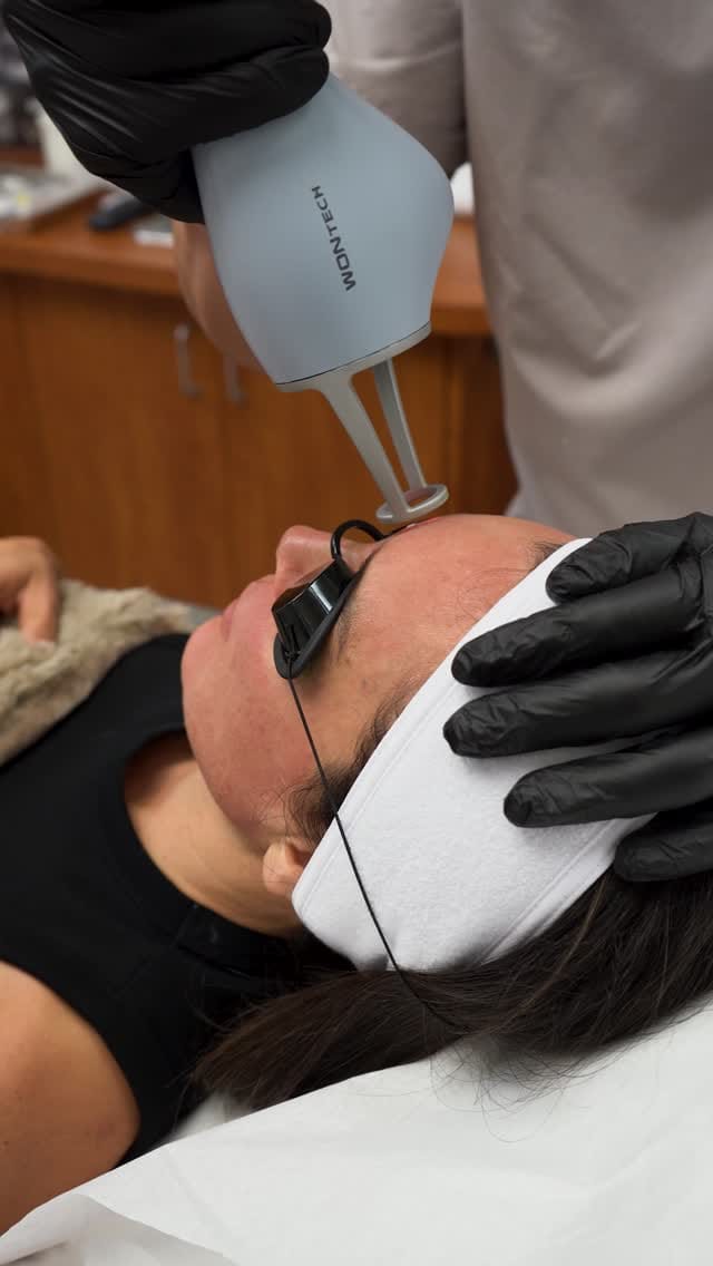 Post 9 by Dr. Thiago Queiroz-Aesthetic Medicine on Instagram (video)