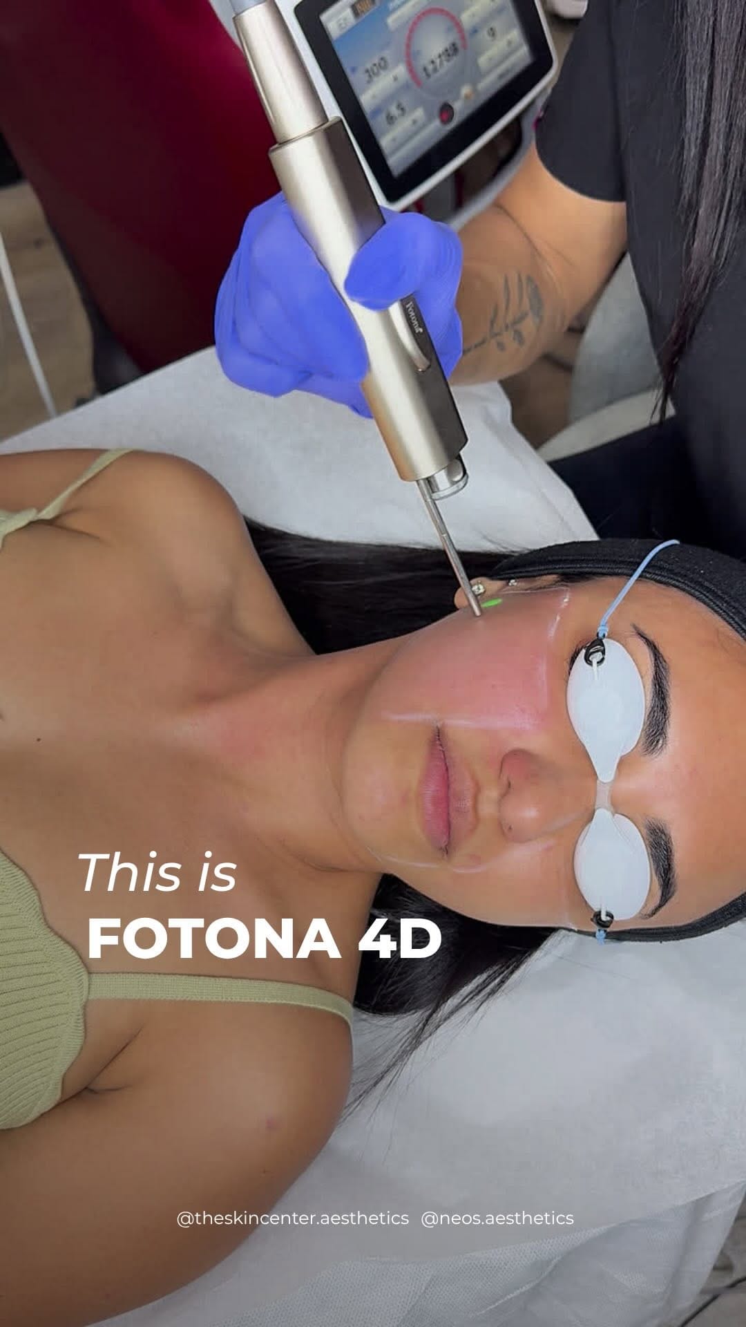 Post 2 by Dr. Thiago Queiroz-Aesthetic Medicine on Instagram (video)