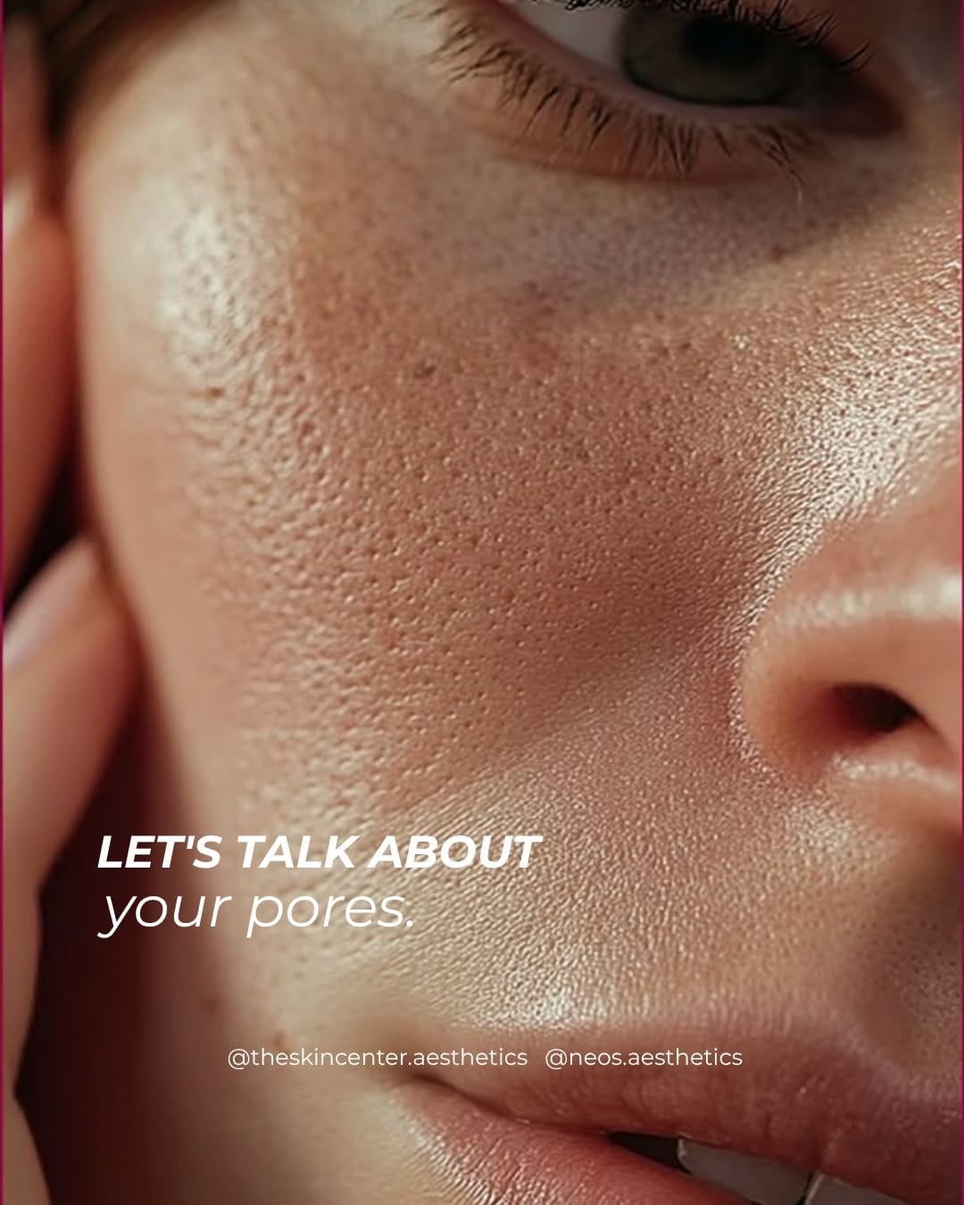 Post 6 by Dr. Thiago Queiroz-Aesthetic Medicine on Instagram (carousel)