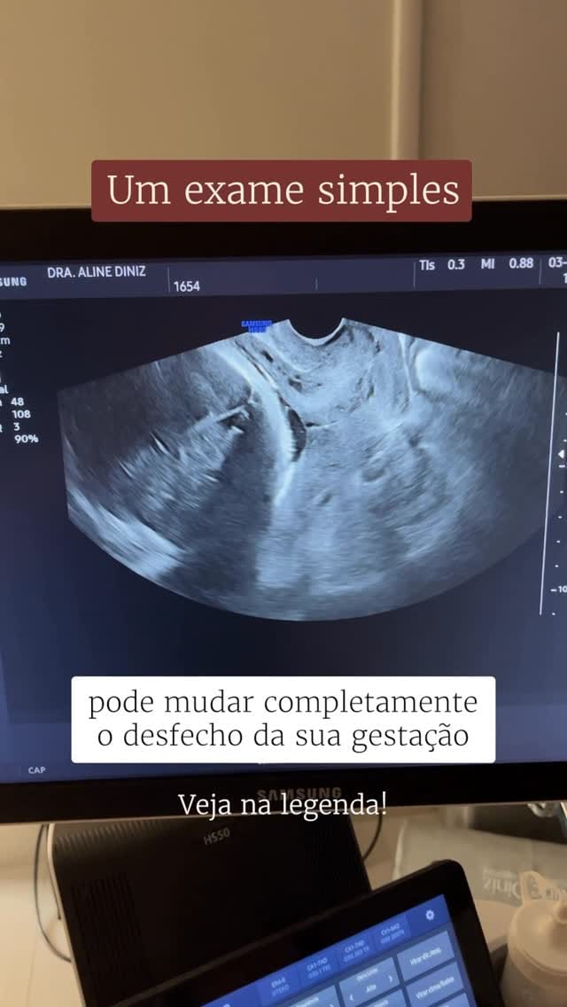 Post 1 by Dra. Aline Diniz | Obstetra - Goiânia/GO on Instagram (video)