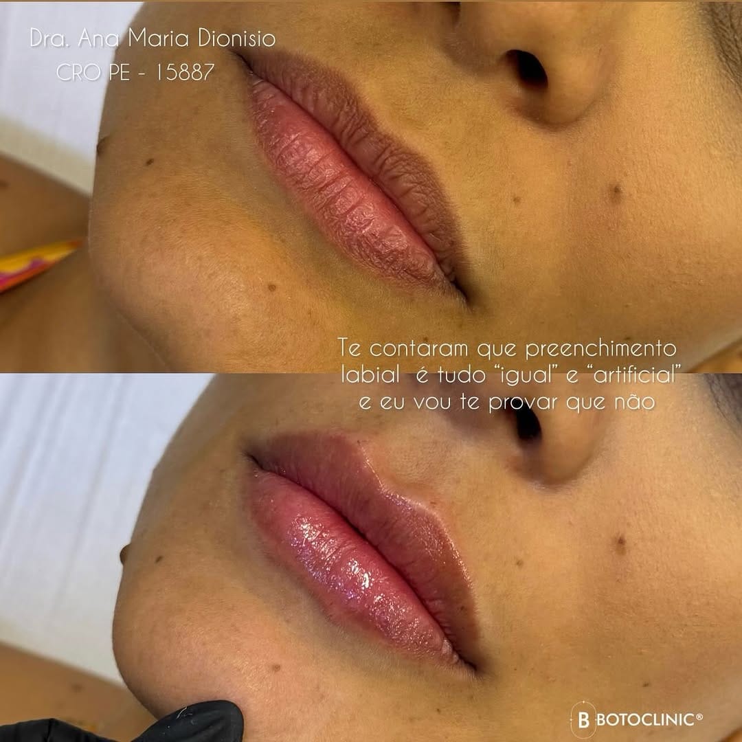 Post 2 by Dra. Ana Maria Dionísio on Instagram (carousel)