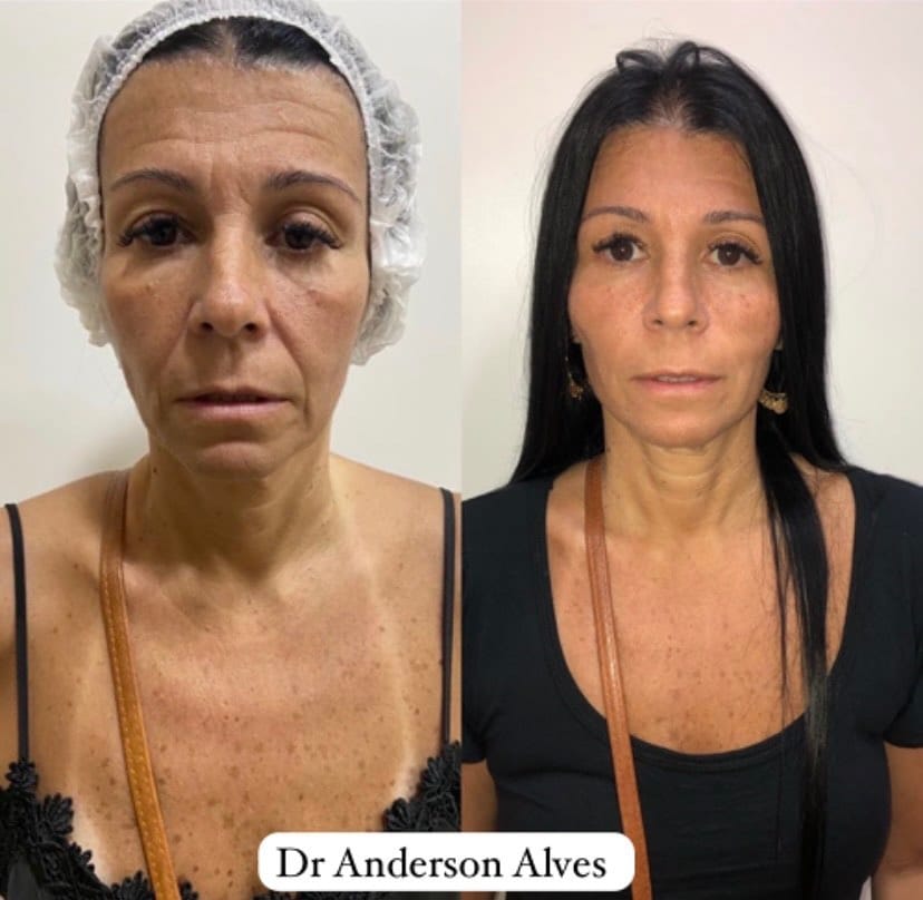 Post 9 by Dr. Anderson Alves de Souza on Instagram (image)