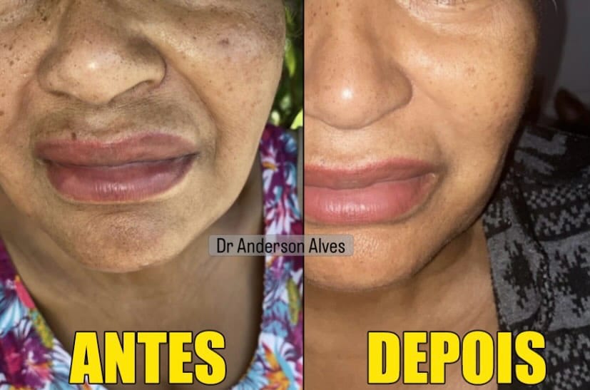 Post 1 by Dr. Anderson Alves de Souza on Instagram (image)