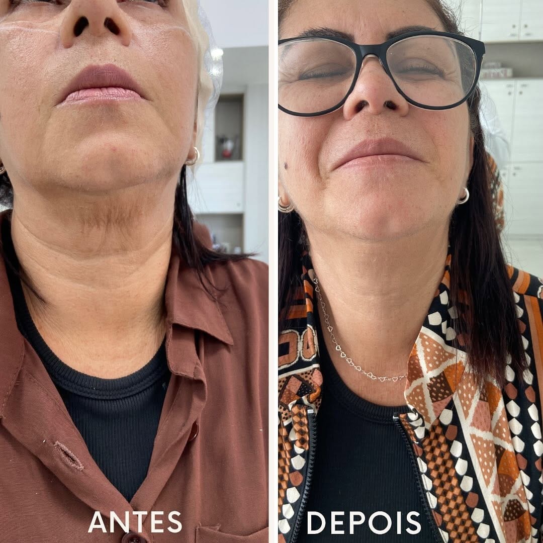 Post 4 by Dr. Anderson Alves de Souza on Instagram (image)