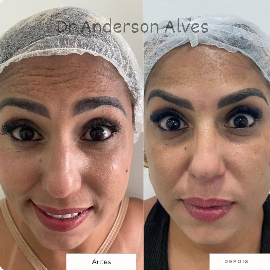 Post 8 by Dr. Anderson Alves de Souza on Instagram (image)