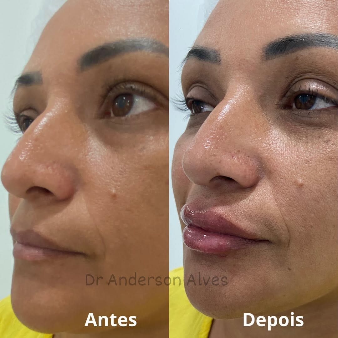 Post 7 by Dr. Anderson Alves de Souza on Instagram (image)