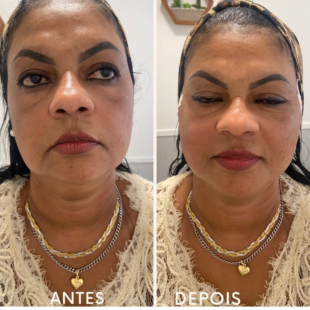 Post 5 by Dr. Anderson Alves de Souza on Instagram (image)