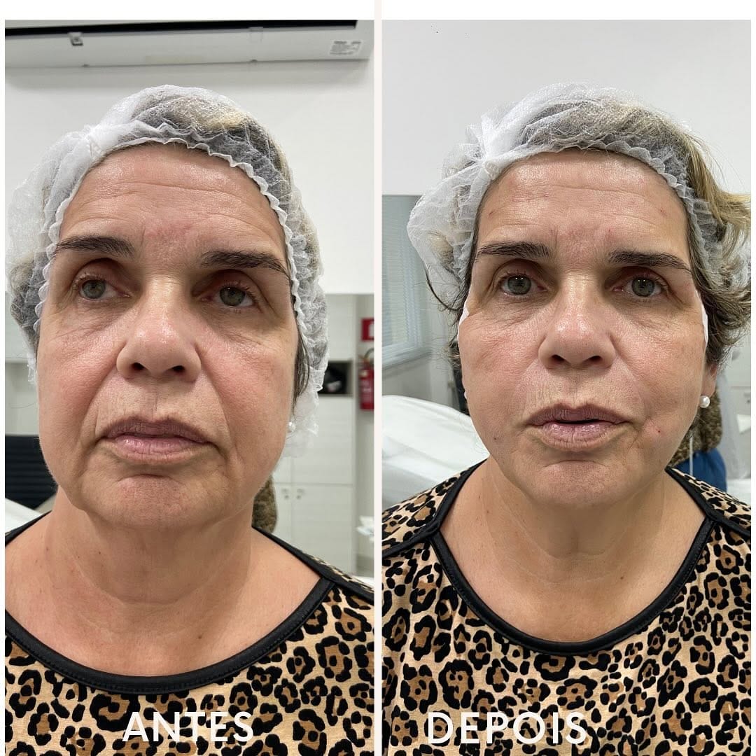 Post 6 by Dr. Anderson Alves de Souza on Instagram (image)