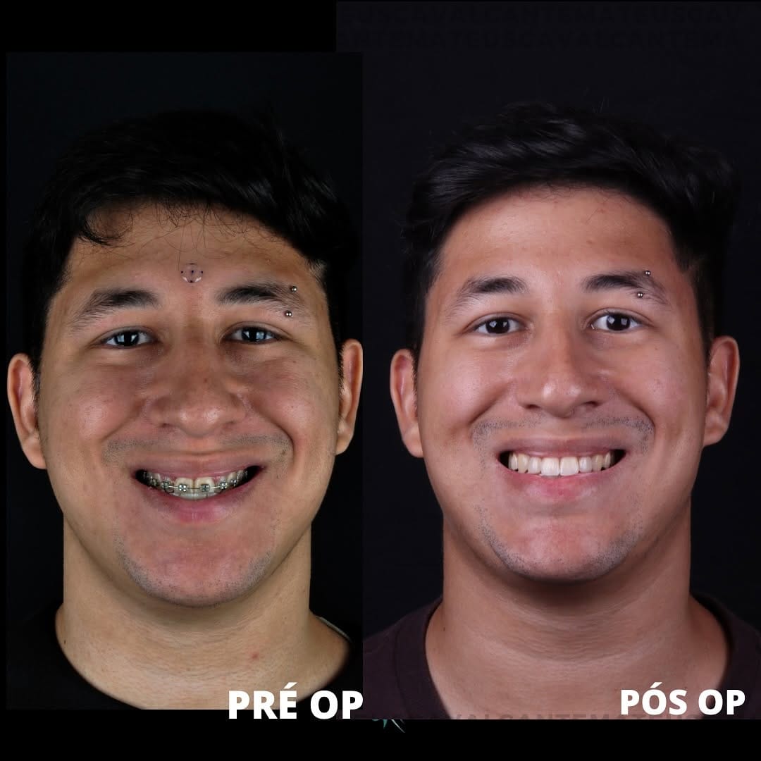 Post 10 by Dr. Mateus Cavalcante. on Instagram (carousel)