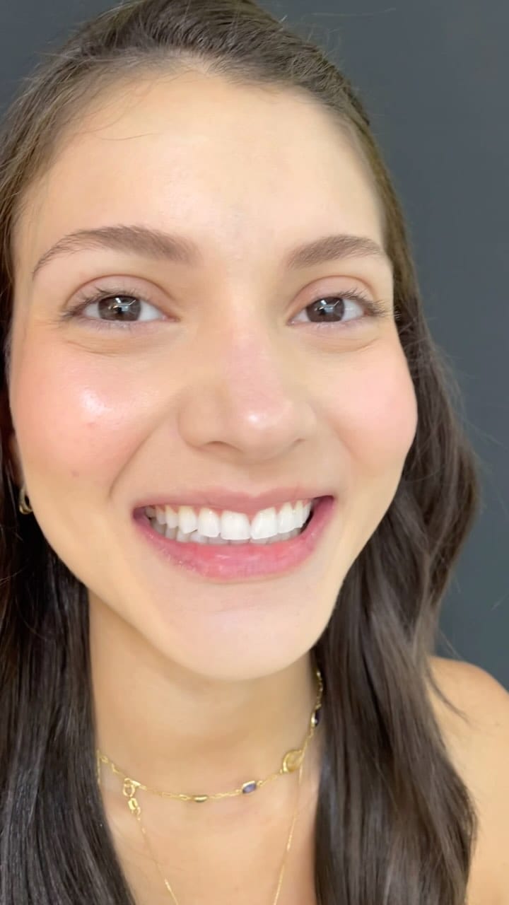 Post 9 by Dra Raíssa Relvas - Dentista Bauru on Instagram (video)