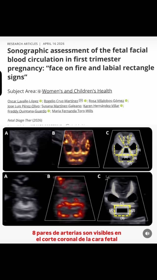 Post 4 by Dr. Angel Pulgar Lehr | Especialista en Salud Materno Fetal on Instagram (video)