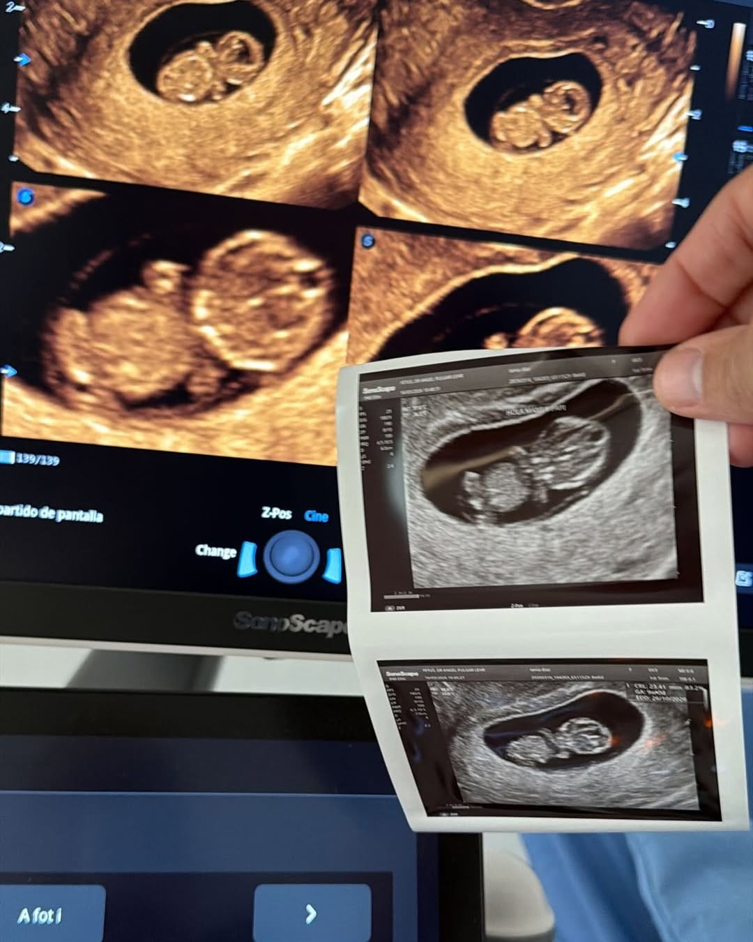 Post 6 by Dr. Angel Pulgar Lehr | Especialista en Salud Materno Fetal on Instagram (image)
