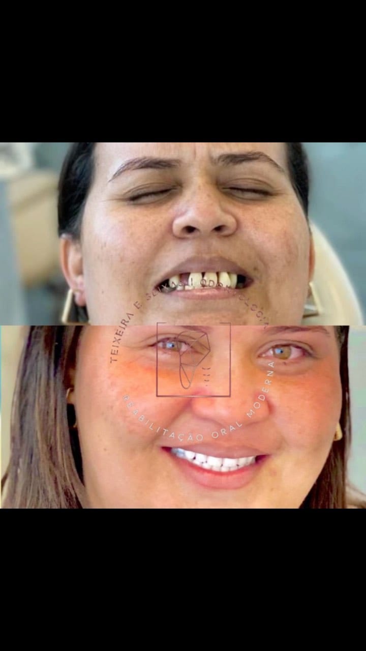 Post 10 by DR. JOÃO SEIXAS | DENTISTA | IMPLANTES on Instagram (video)