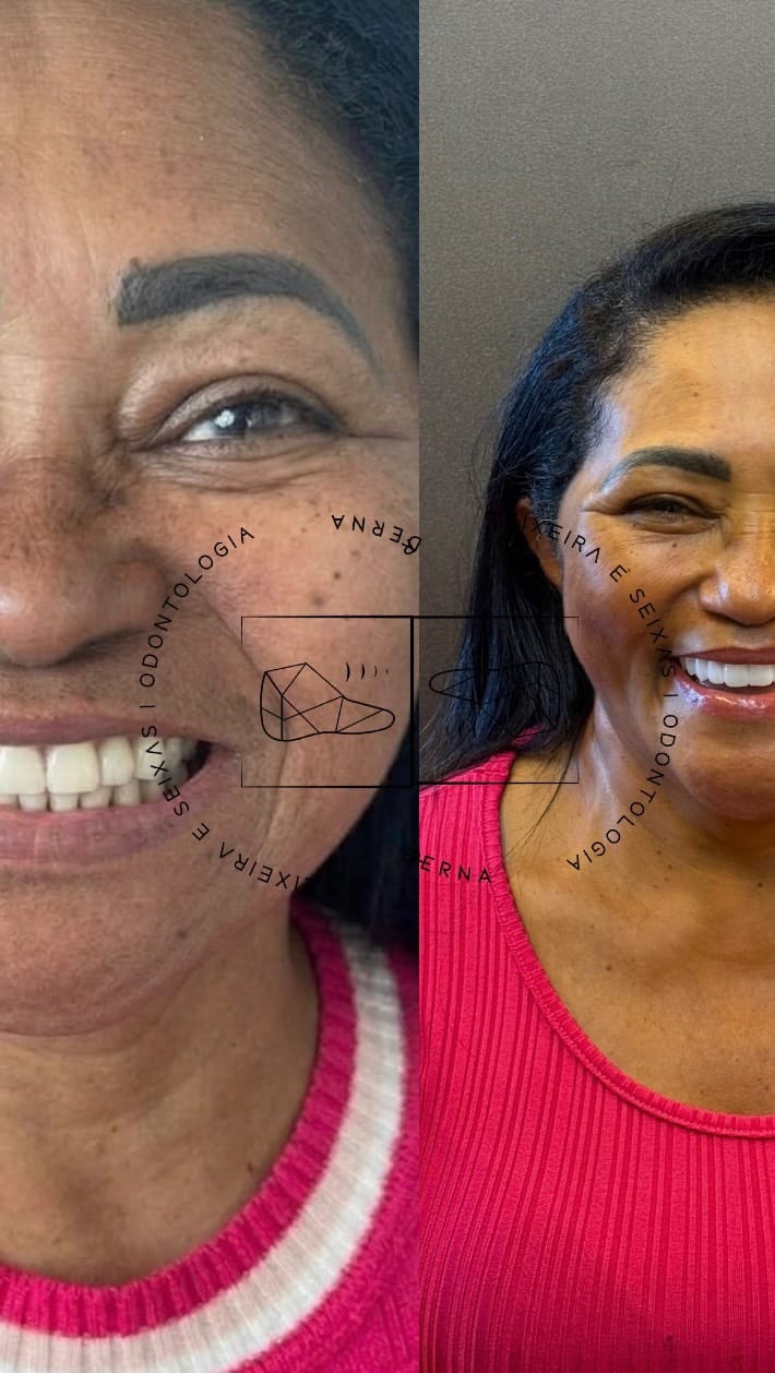 Post 7 by DR. JOÃO SEIXAS | DENTISTA | IMPLANTES on Instagram (video)