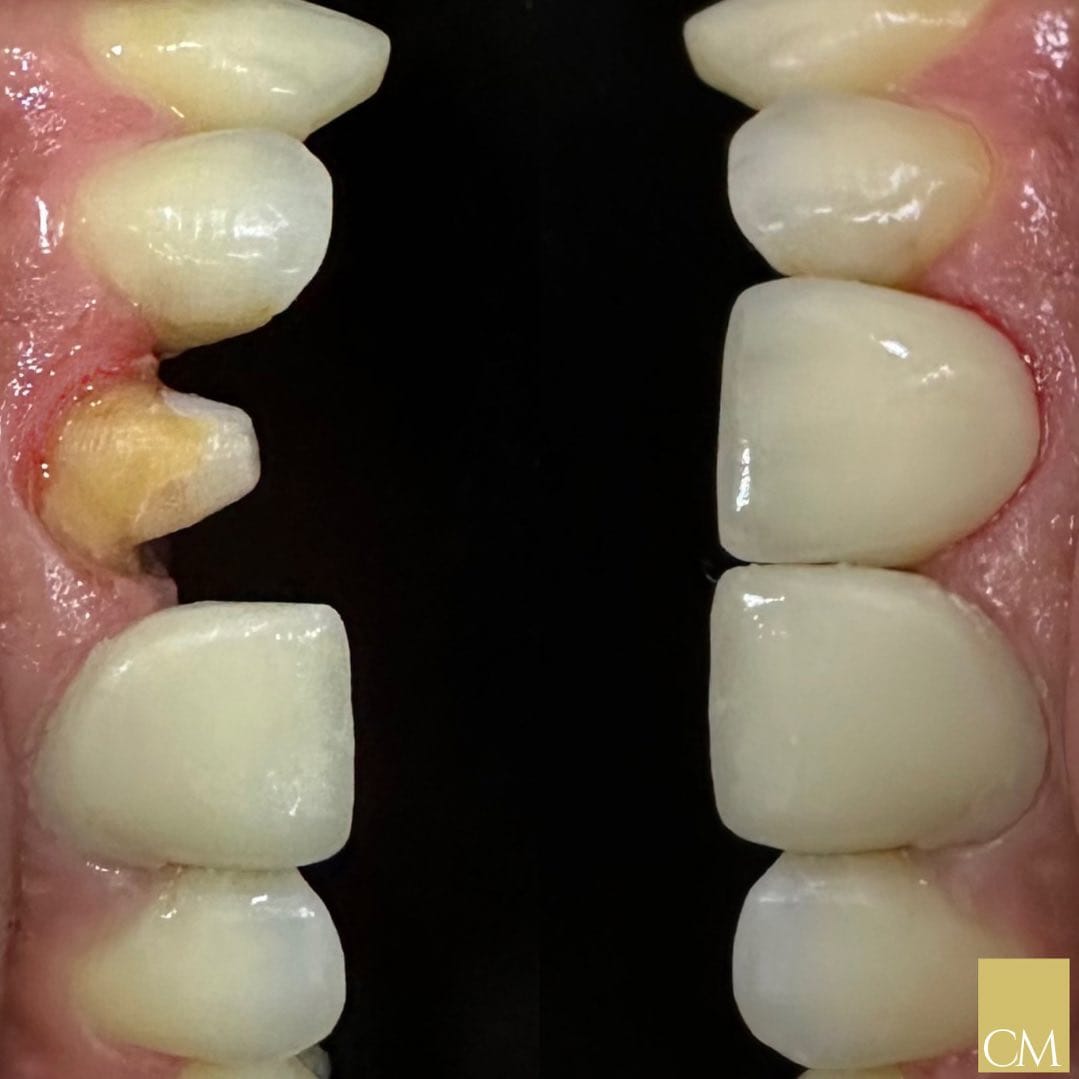 Post 8 by ⚜️Dr. César Medeiros | DENTISTA on Instagram (image)