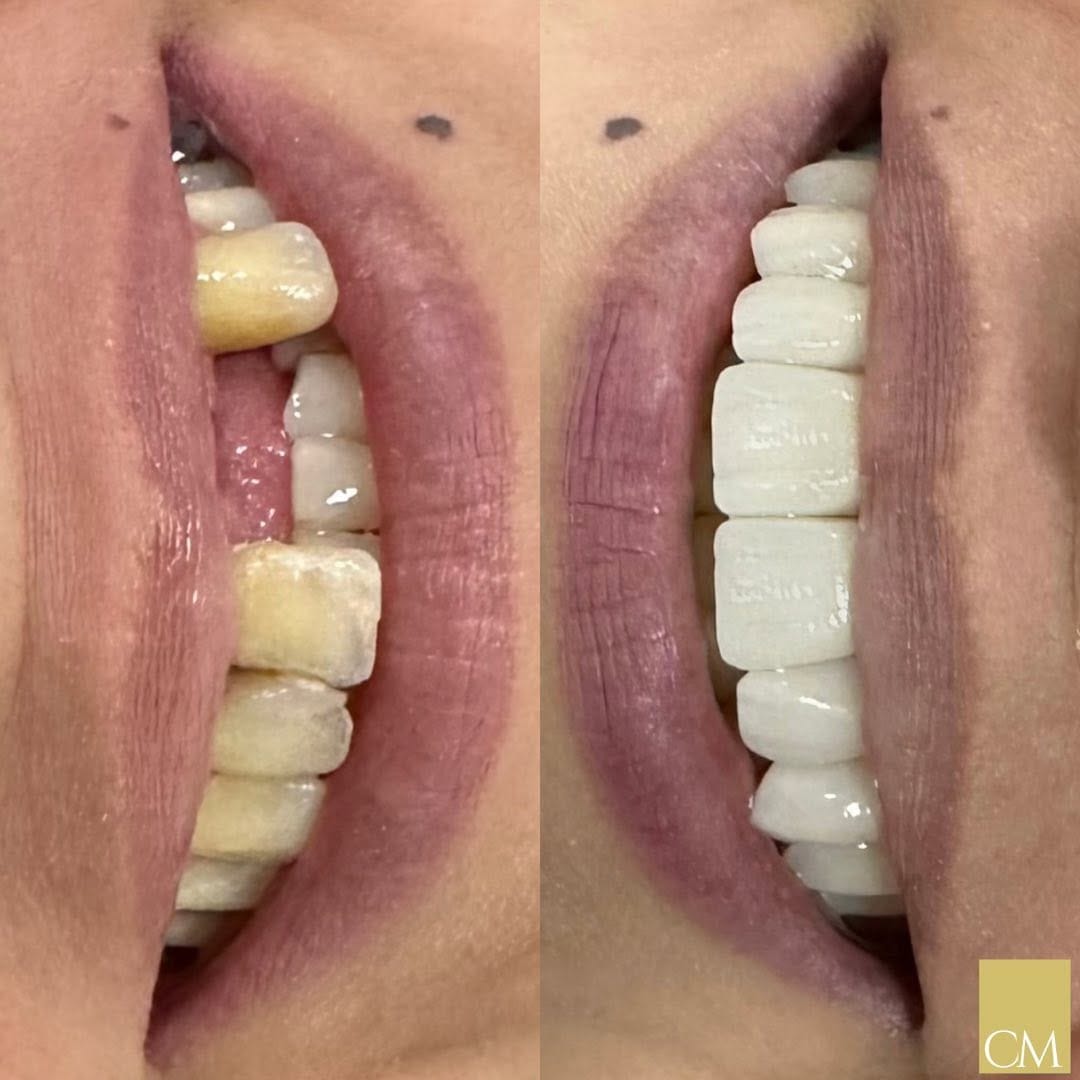 Post 9 by ⚜️Dr. César Medeiros | DENTISTA on Instagram (carousel)