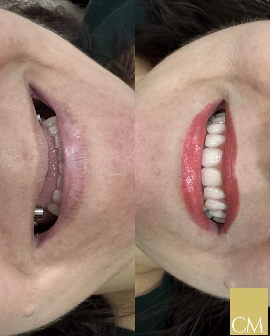 Post 6 by ⚜️Dr. César Medeiros | DENTISTA on Instagram (image)