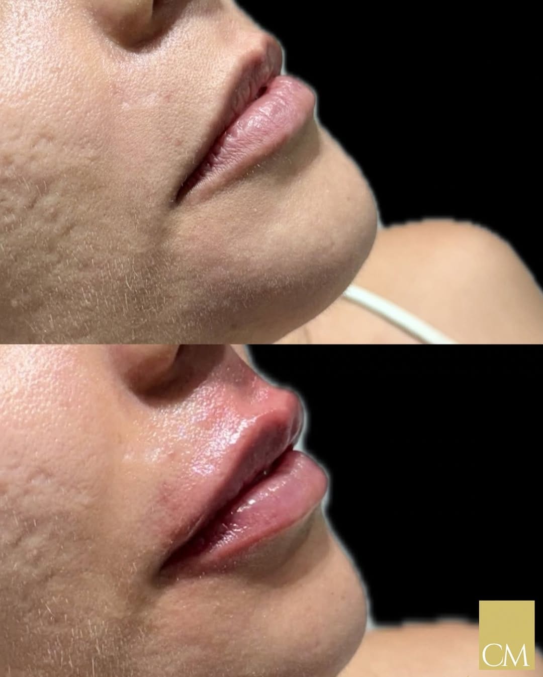 Post 2 by ⚜️Dr. César Medeiros | DENTISTA on Instagram (image)