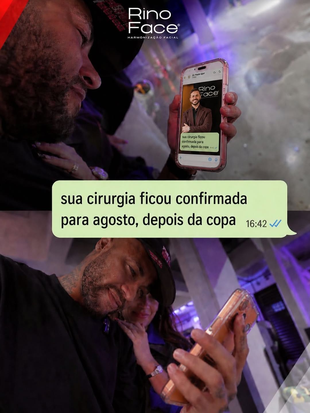 Post 4 by Dr. Paulo Igor - Rinoplastia on Instagram (image)