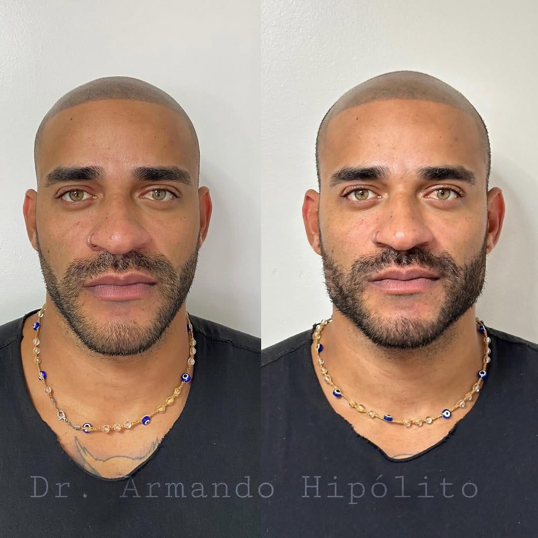 Post 9 by Dr. Armando Hipólito on Instagram (image)