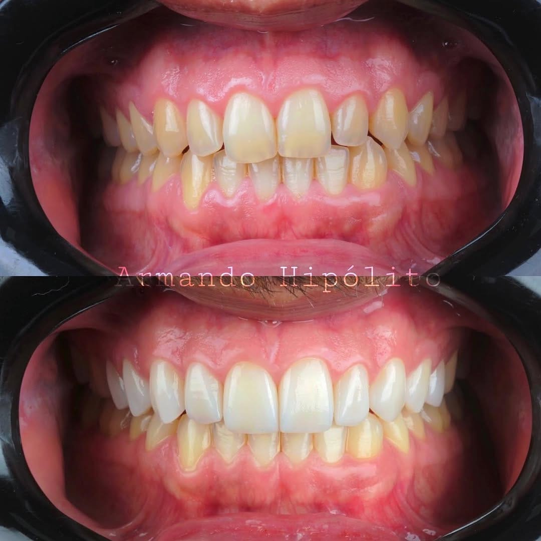 Post 10 by Dr. Armando Hipólito on Instagram (image)