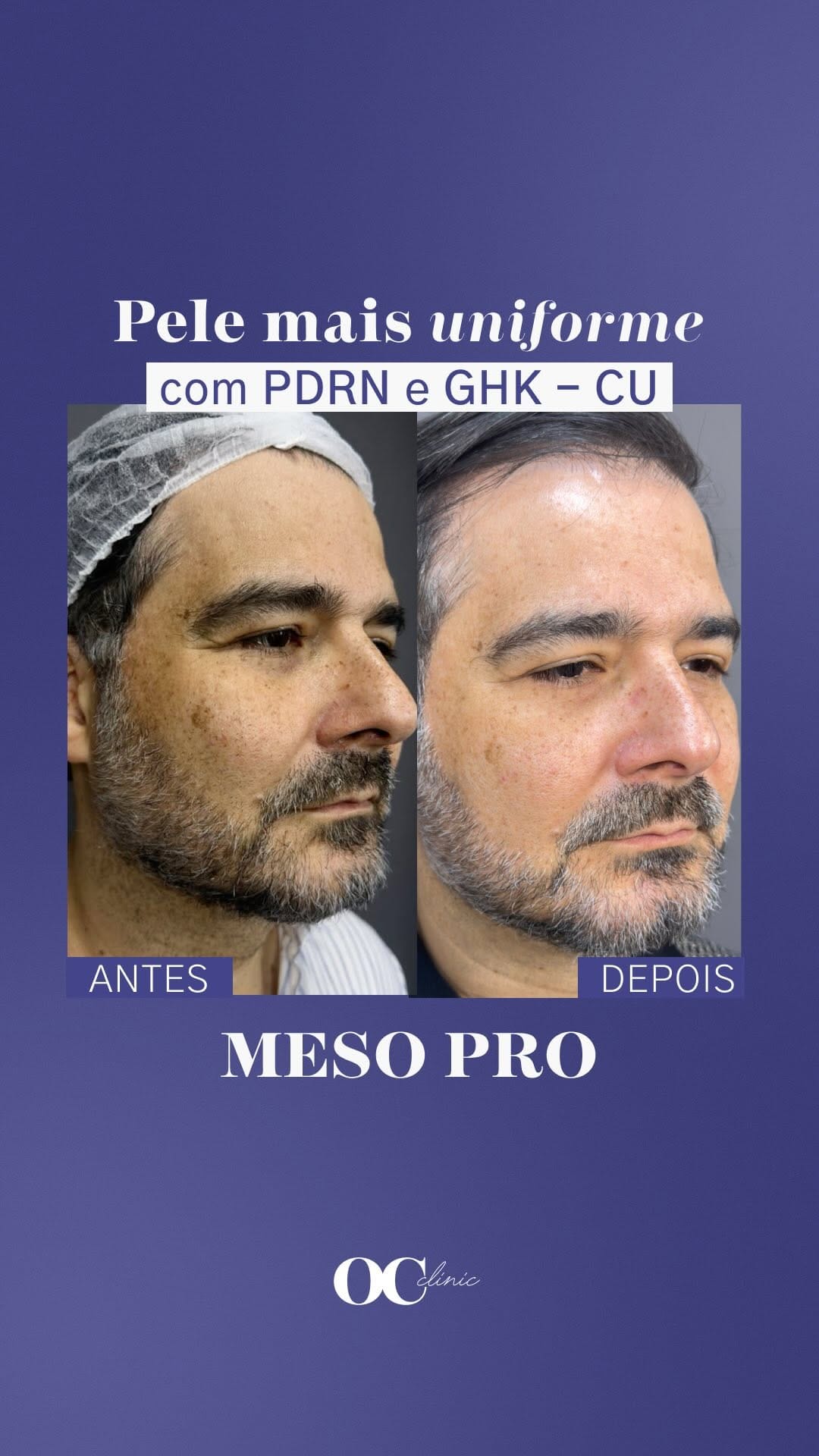 Post 1 by Celso Cavalcanti on Instagram (video)
