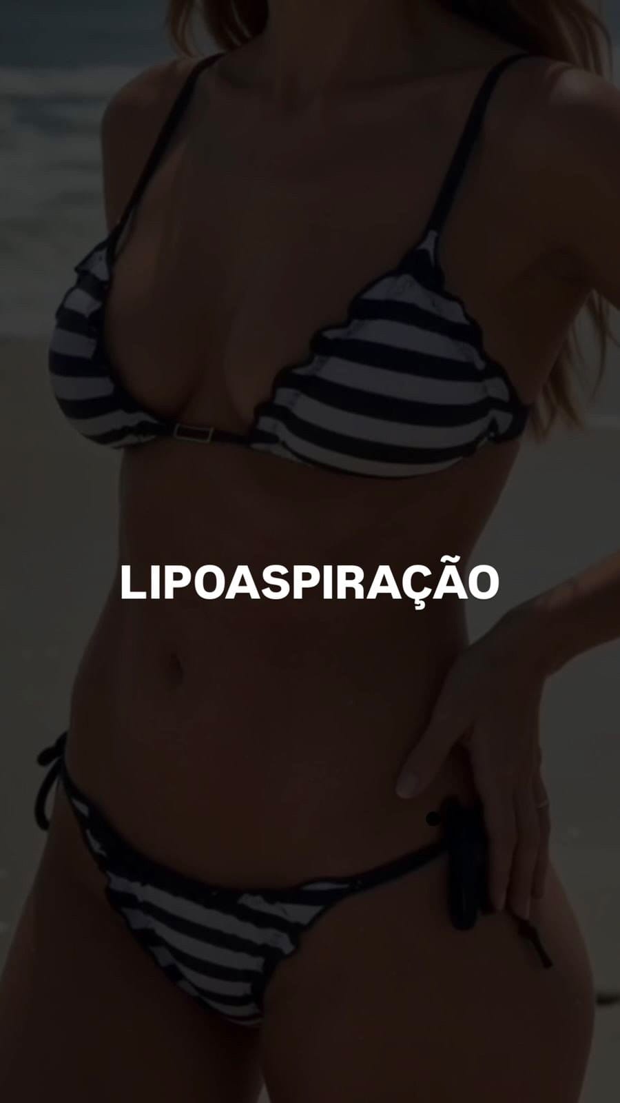 Post 3 by Dr. Tiago Cachuba | Cirurgião Plástico on Instagram (video)
