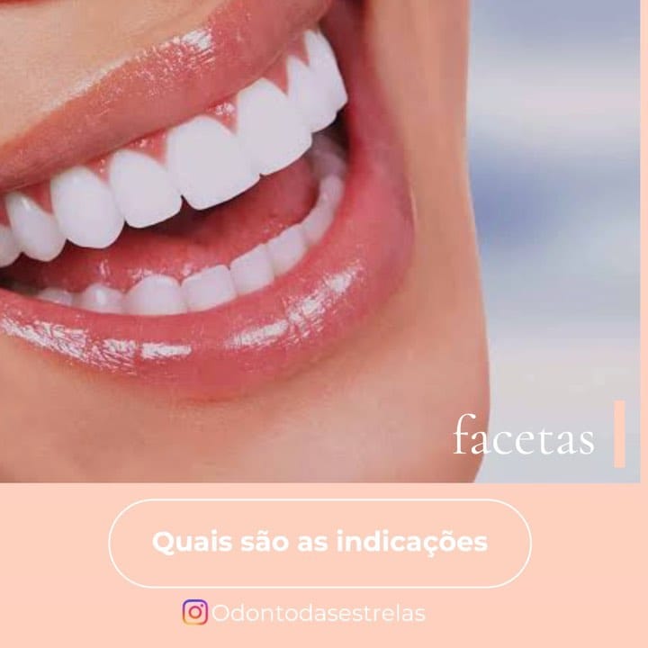Post 6 by Odonto Das Estrelas☎️ on Instagram (video)