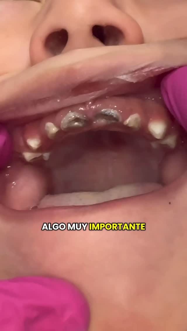 Post 8 by Dr. Raúl A. García on Instagram (video)
