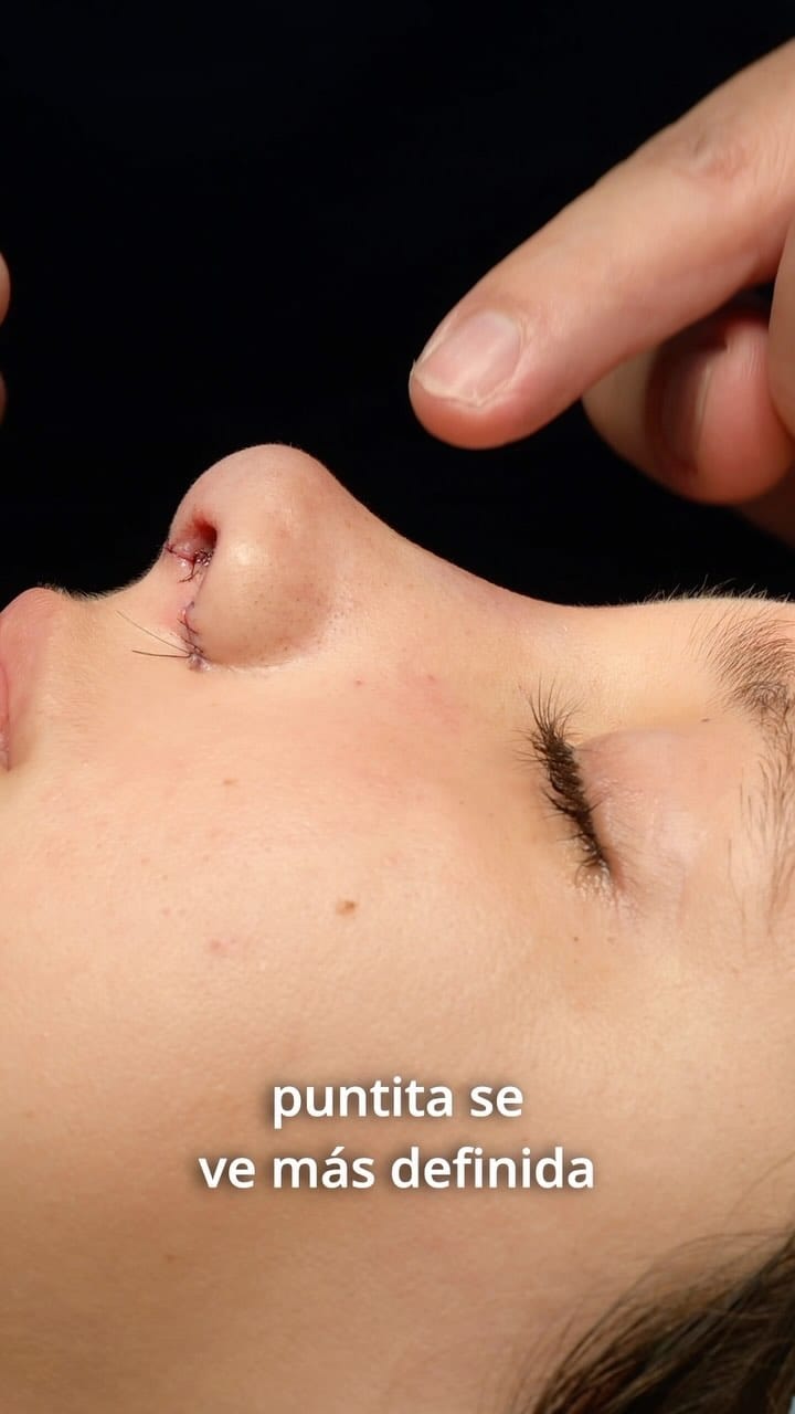 Post 8 by Dr. Carlos Rosales on Instagram (video)