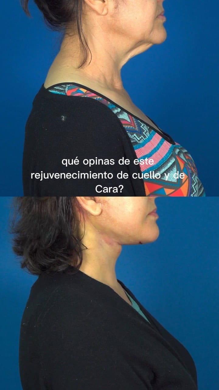 Post 9 by Dr. Carlos Rosales on Instagram (video)