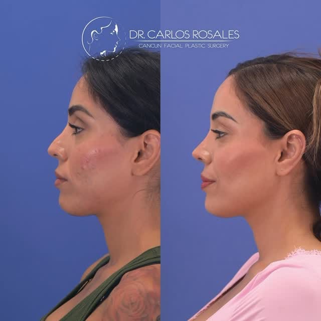 Post 2 by Dr. Carlos Rosales on Instagram (video)