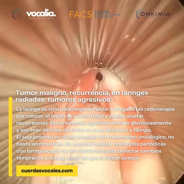 Post 7 by Dr. Gerardo López Guerra | Laringología y Trastornos de la Voz on Instagram (video)