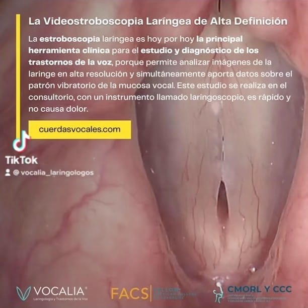 Post 10 by Dr. Gerardo López Guerra | Laringología y Trastornos de la Voz on Instagram (video)