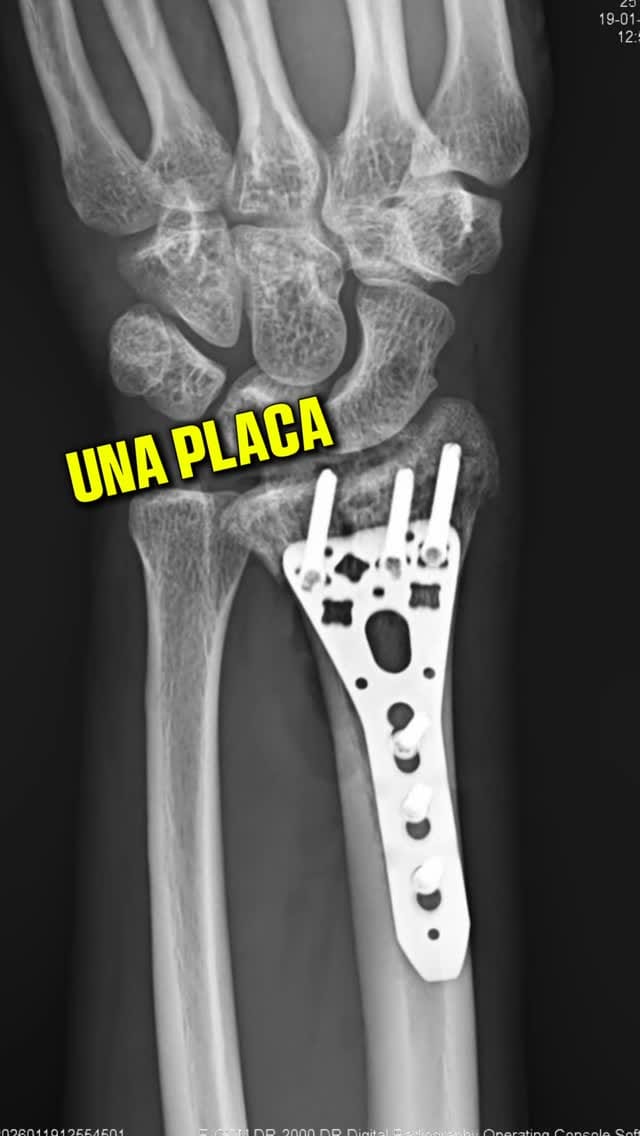 Post 7 by Luis Volada on Instagram (video)